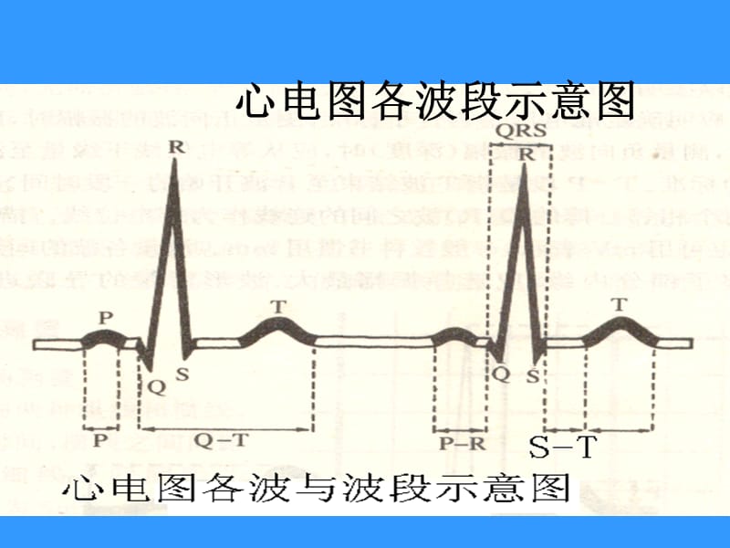 常见心电图分析.ppt_第2页