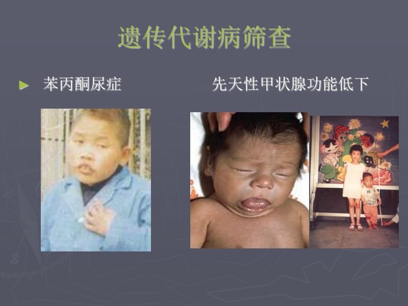 新生儿疾病筛查知识.ppt_第3页