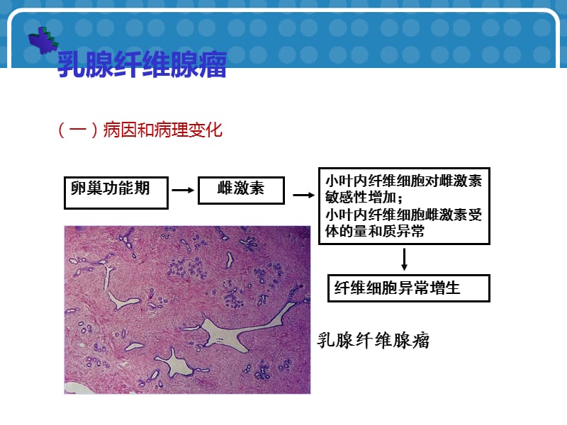 常见乳腺肿瘤的影像表现.ppt_第3页