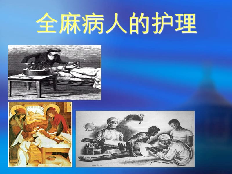 全麻病人护理.ppt_第1页