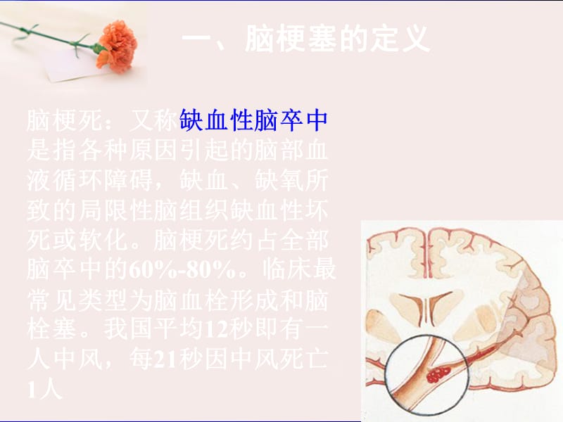 急性脑梗塞溶栓治疗护理.ppt_第2页