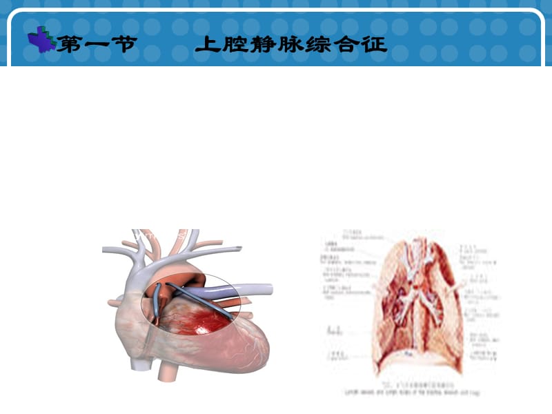 常见肿瘤急症的诊断与处理.ppt_第3页