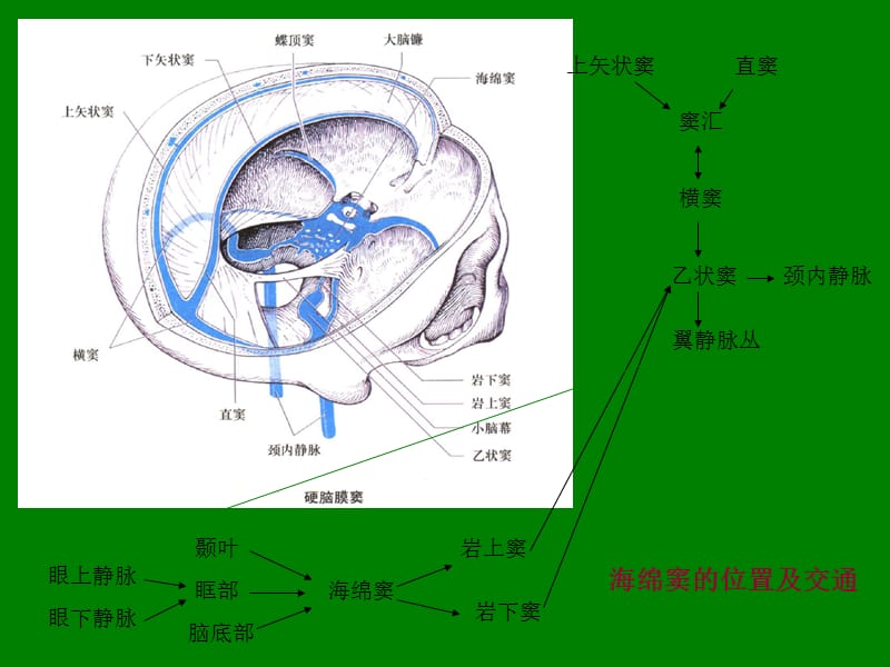 海绵窦综合征、眶上裂综合征及眶尖综合征.ppt_第3页