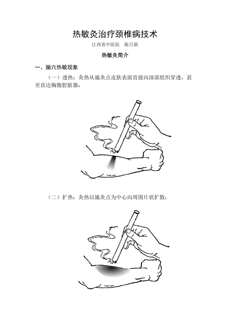 热敏灸治疗颈椎病技术陈日新.doc_第1页