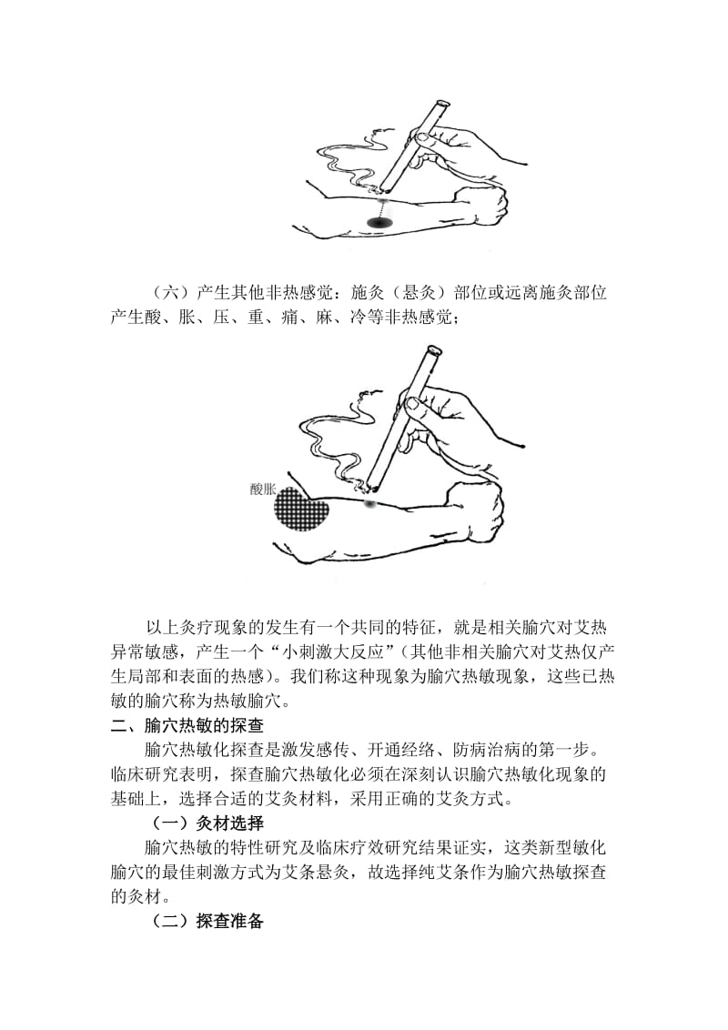 热敏灸治疗颈椎病技术陈日新.doc_第3页