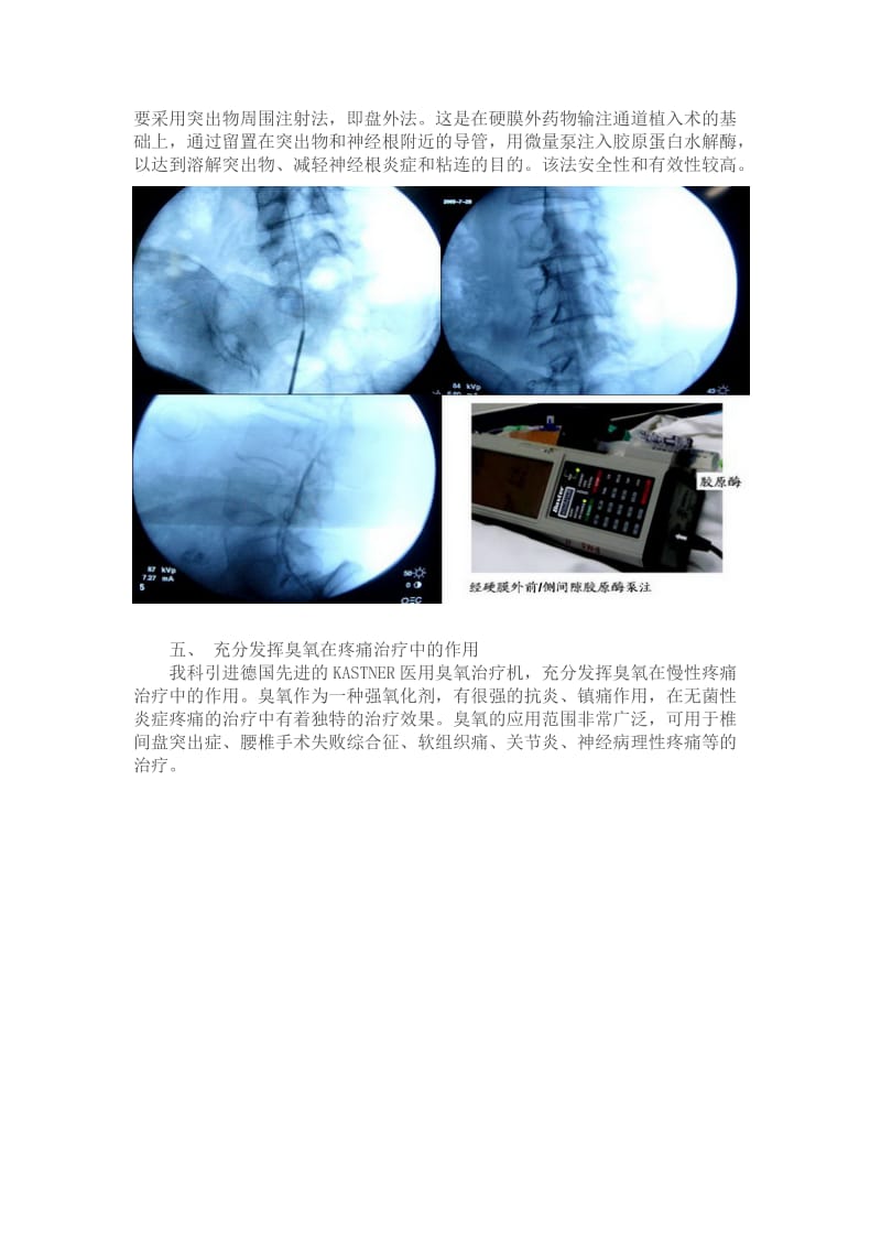 疼痛治疗中心常见的治疗技术.doc_第3页