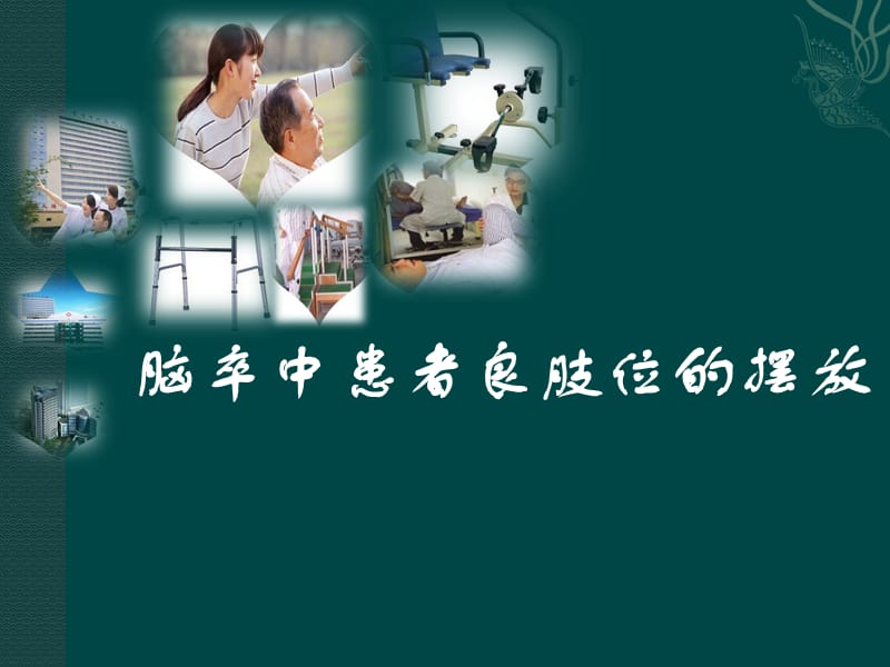 脑卒中患者良肢位的摆放.ppt_第1页