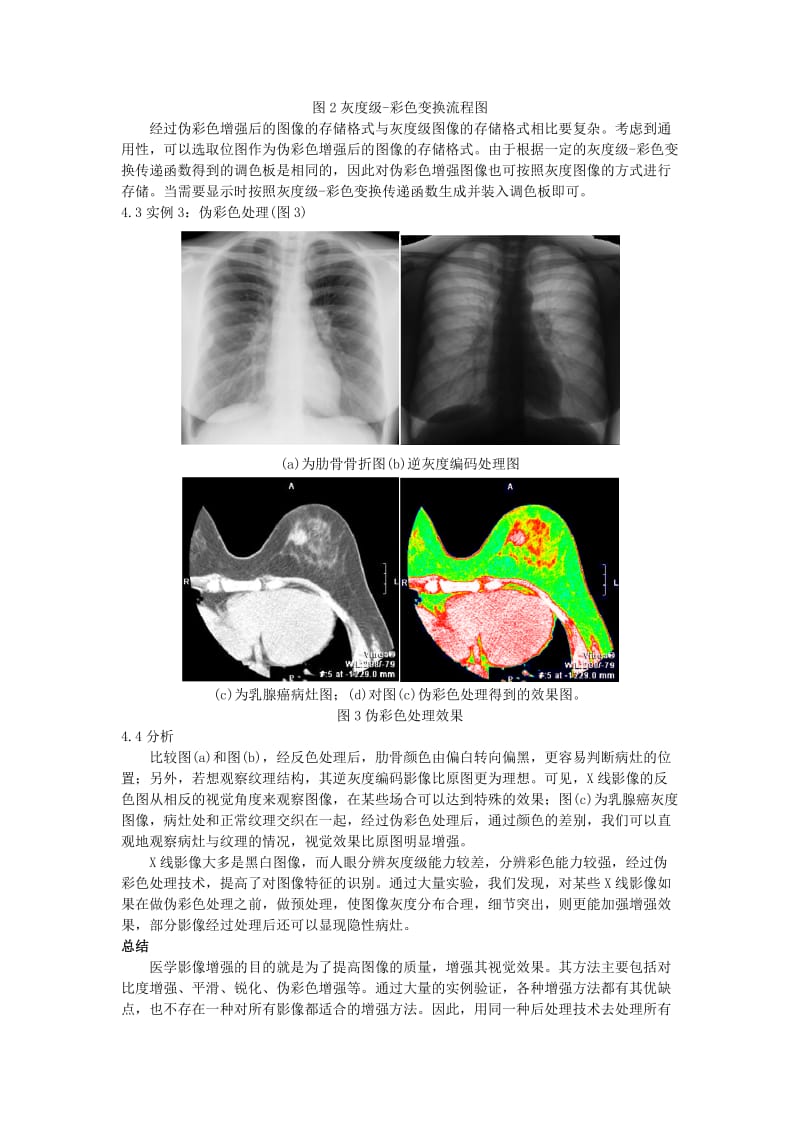 医学影像后处理技术在X线影像优化中的应用.doc_第3页