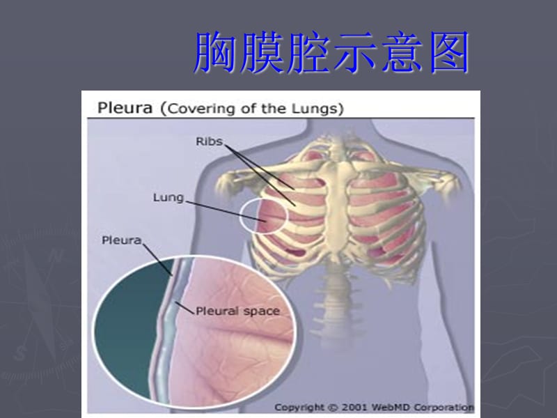 胸膜疾病8版.ppt_第2页