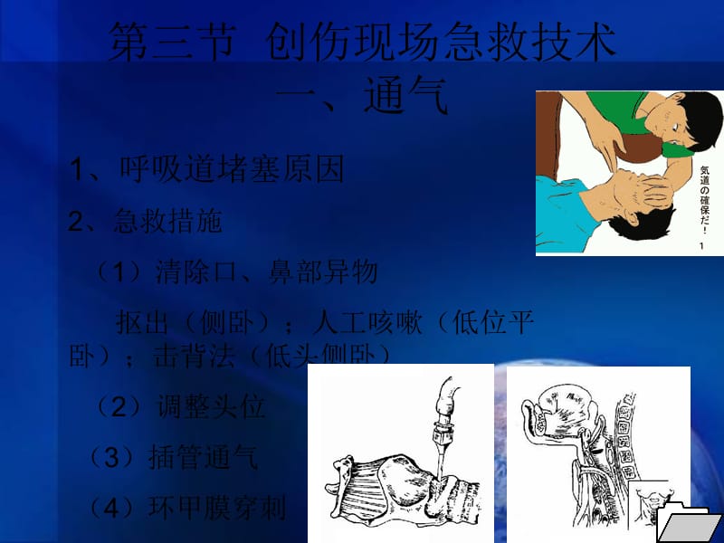 现场急救.ppt_第1页