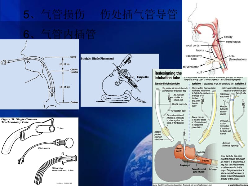 现场急救.ppt_第3页