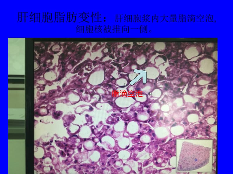 病理学实验切片考试图片58263.ppt_第2页