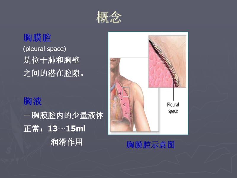 胸腔积液患者的护理.ppt_第3页