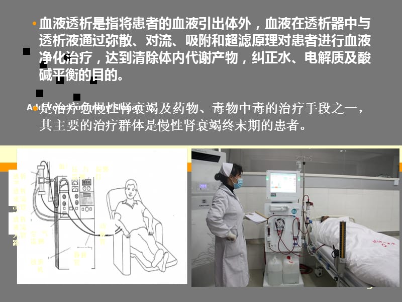 血液透析相关基础知识.ppt_第2页