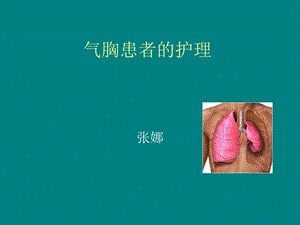 氣胸患者的護(hù)理 演示文稿.ppt