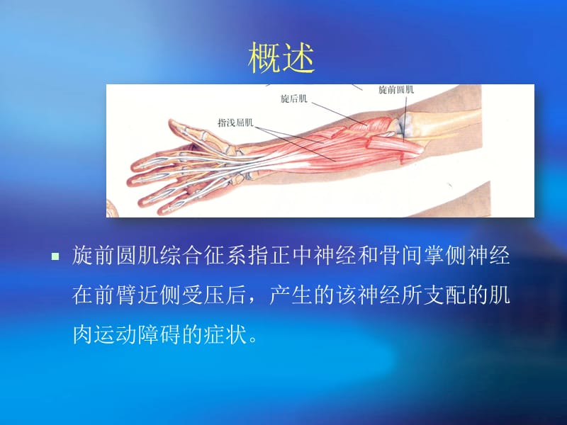 旋前圆肌综合症(精).ppt_第3页