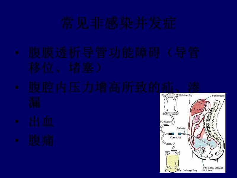 腹膜透析相关并发症的处理.ppt_第3页