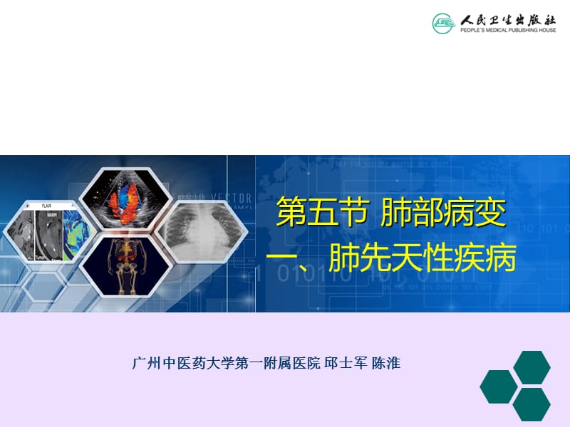 肺部病变影像学诊断.ppt_第2页