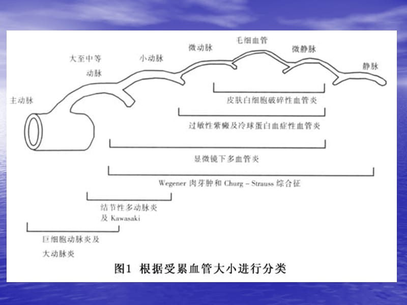 血管炎患者的治疗与护理.ppt_第3页