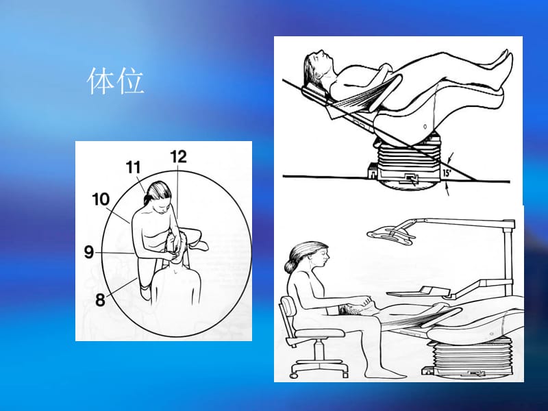 牙周器械的识别.ppt_第2页