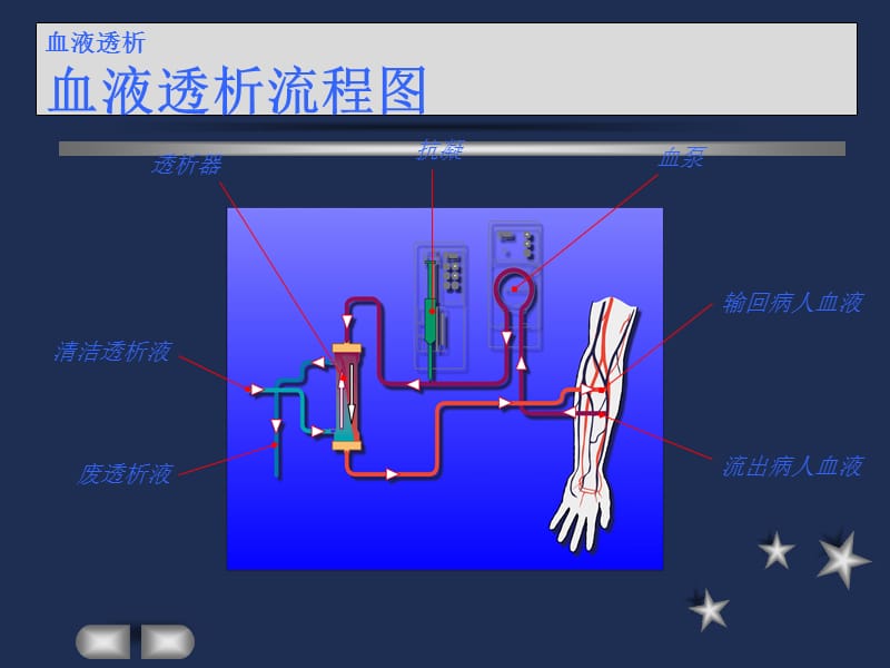 费森尤斯透析器知识.ppt_第2页