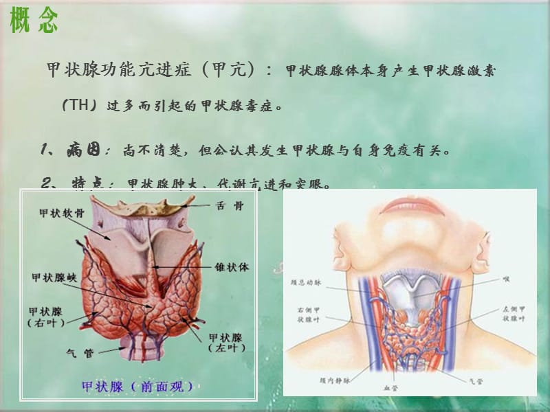 甲状腺功能亢进患者护理查房.ppt_第2页