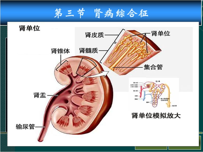 肾病综合征PPT.ppt_第1页