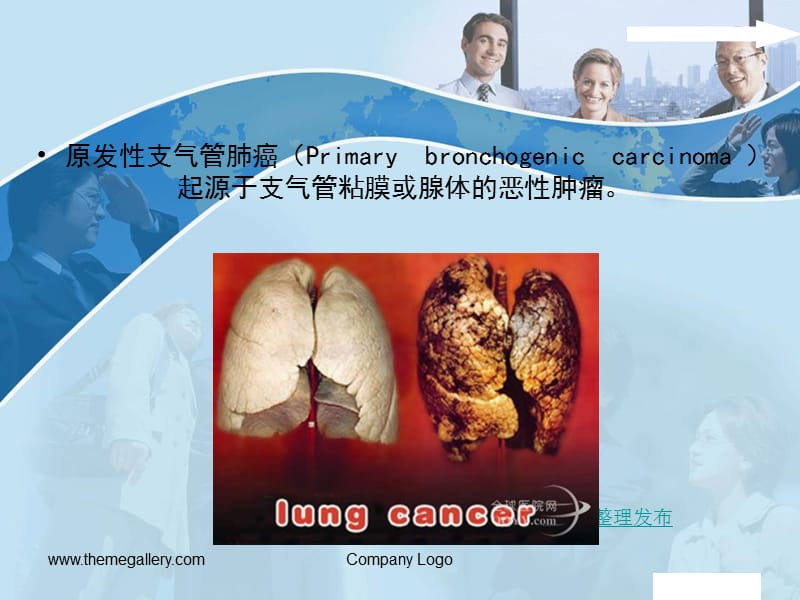 肺癌的影像诊断PPT.ppt_第3页