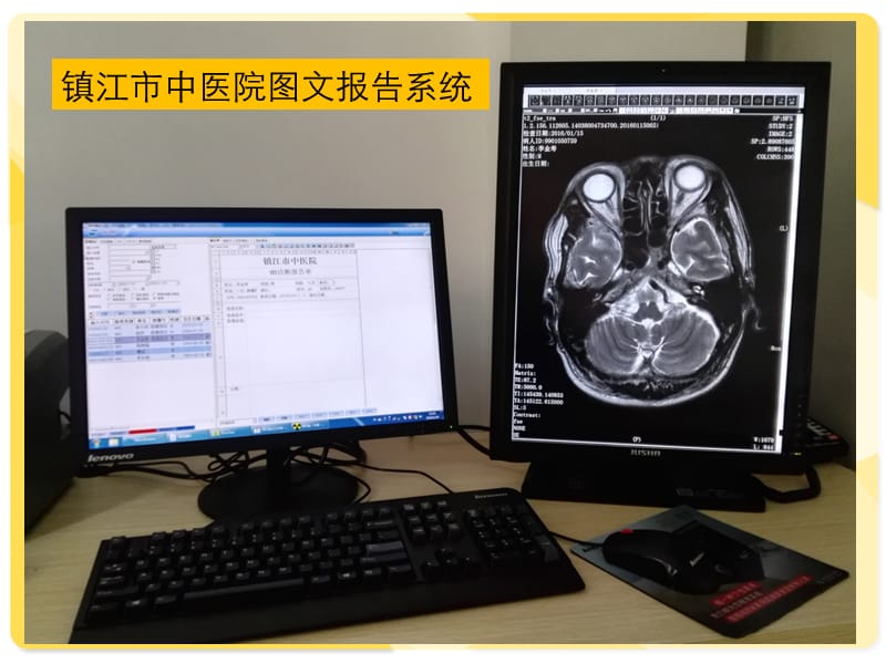 脑血管疾病的MRI诊断.ppt_第3页