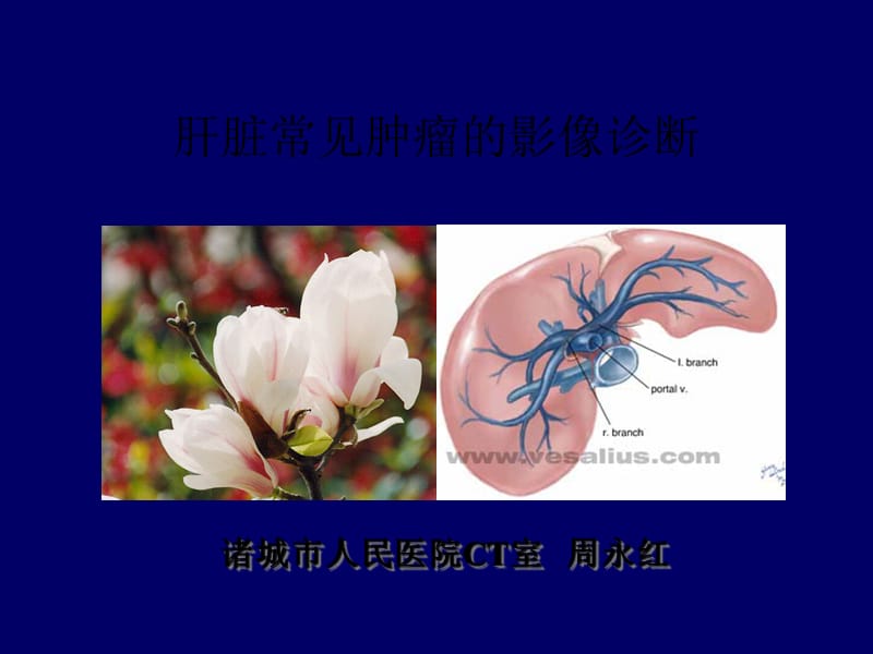 肝脏肿瘤的影像诊断.ppt_第1页