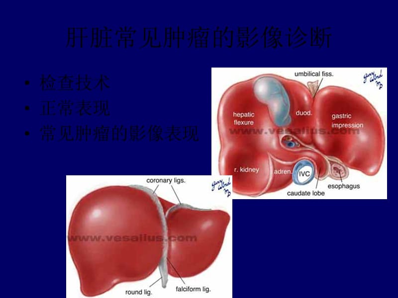 肝脏肿瘤的影像诊断.ppt_第2页