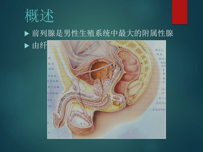 磁共振_前列腺癌.ppt_第2页