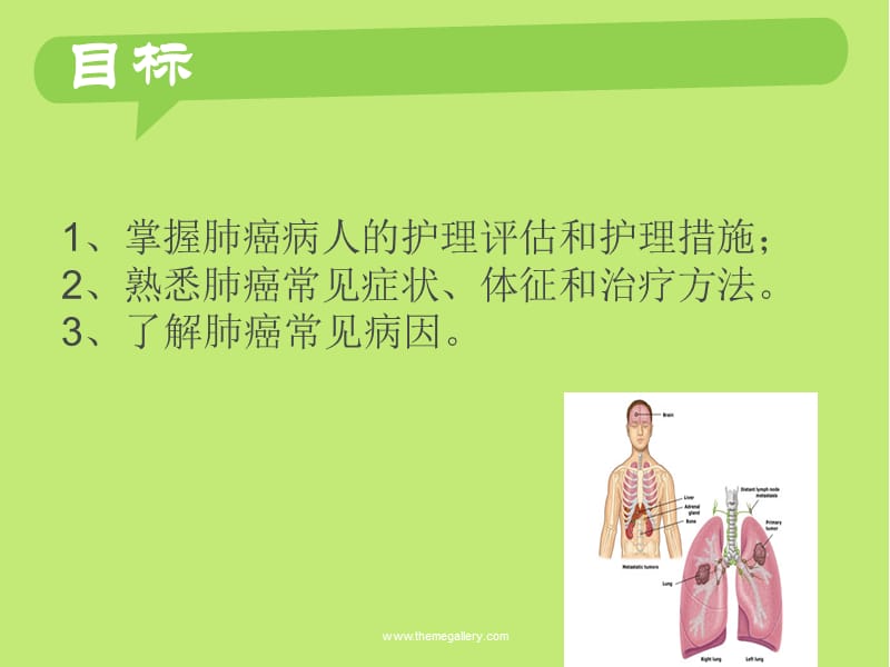 肺癌病人的护理(带案例).ppt_第2页