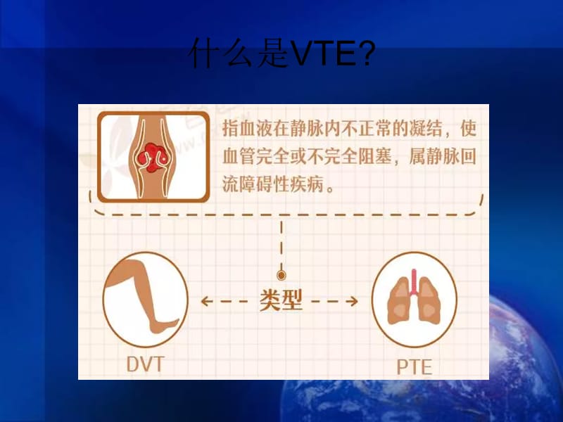 血栓的预防与管理.ppt_第2页