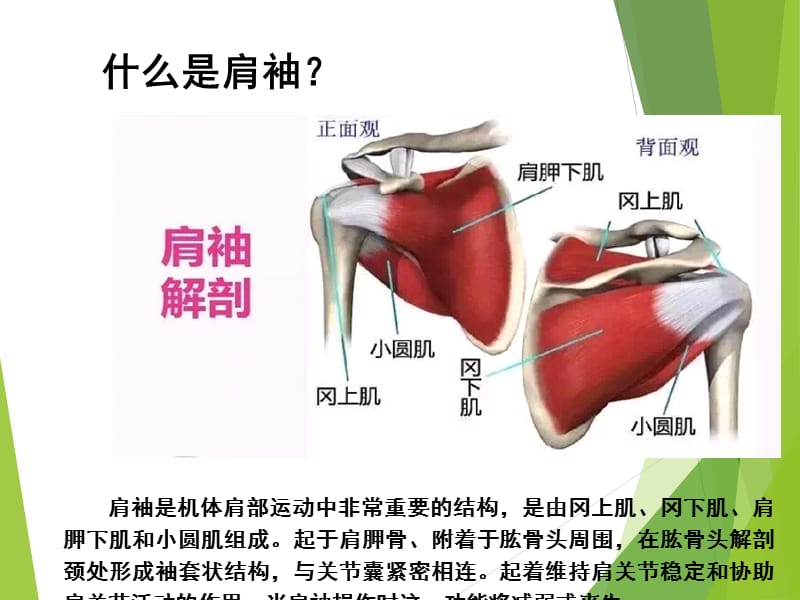 肩袖损伤护理疾病查房.ppt_第3页