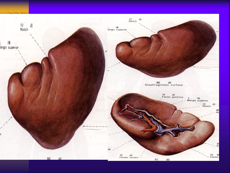 脾脏疾病影像诊断.ppt_第3页