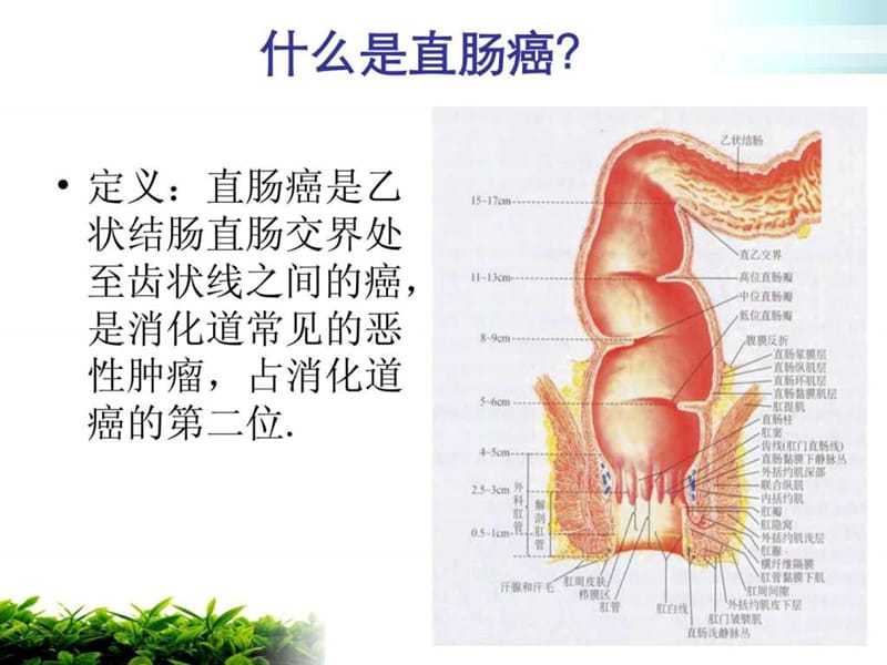 直肠癌 护理查房.ppt_第3页