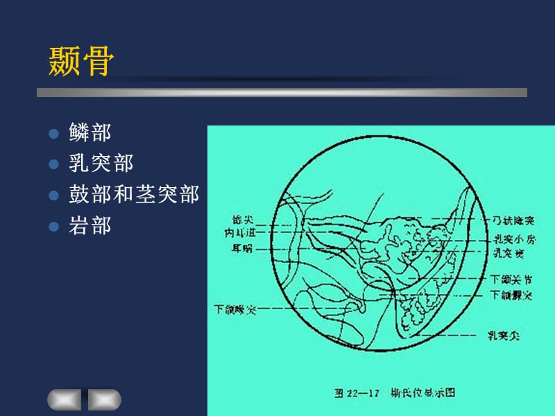 耳内疾病影像诊断.ppt_第2页