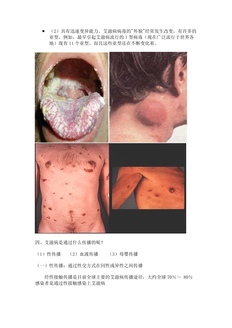 预防艾滋病教案总结.doc_第3页