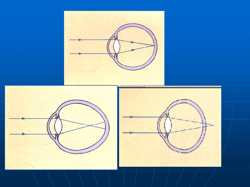 近视的预防课件.ppt_第3页