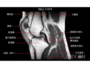 《膝部MRI解剖》PPT课件
