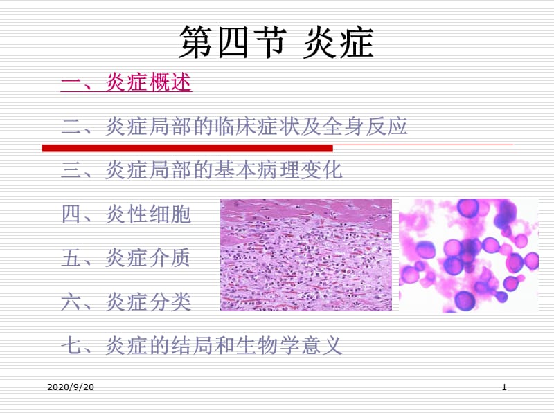 《病理学五》ppt课件_第1页