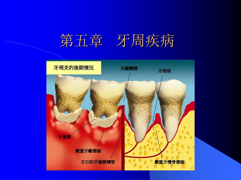 《牙周組織疾病》PPT課件_第1頁