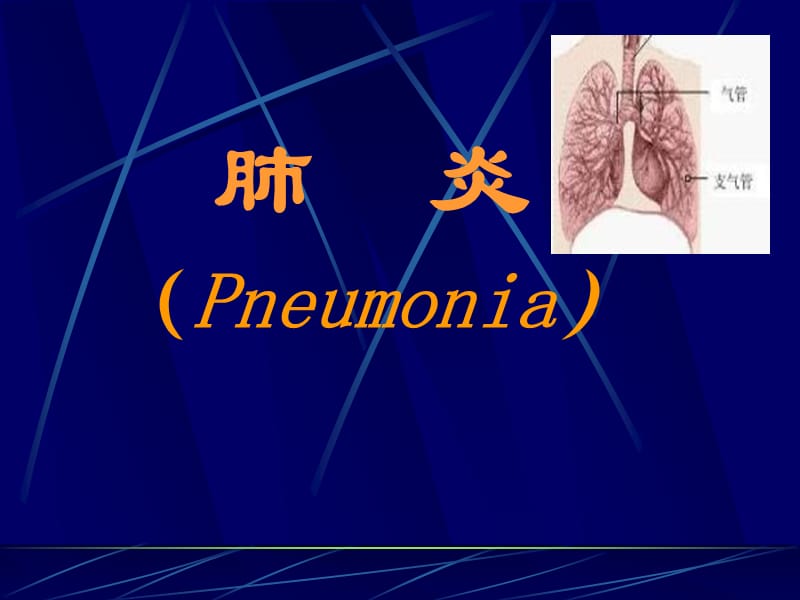 《肺炎教学》ppt课件_第1页