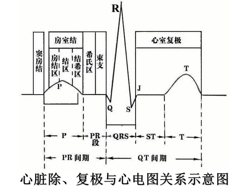 《心电图图谱》ppt课件_第1页