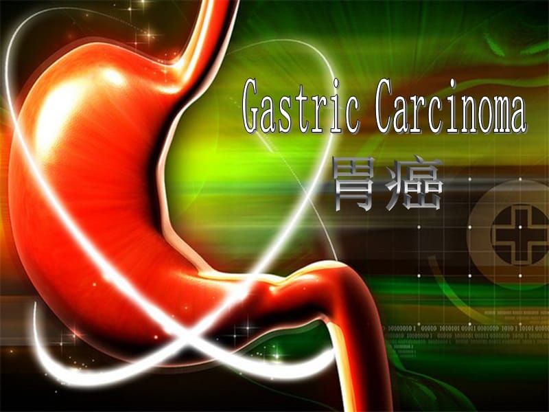 医学英语疾病介绍——gastriccarcinoma胃癌ppt课件_第1页