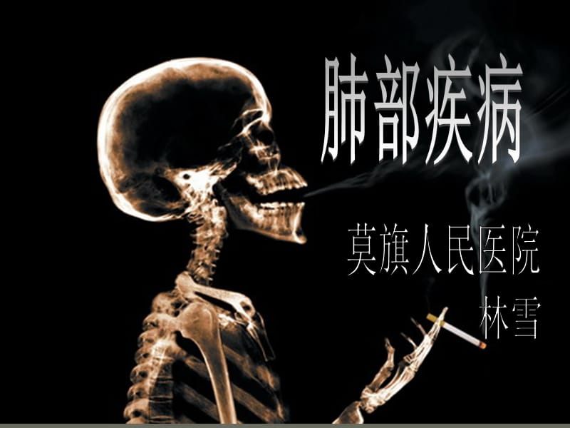 医学ppt--肺部疾病的x诊断_第1页