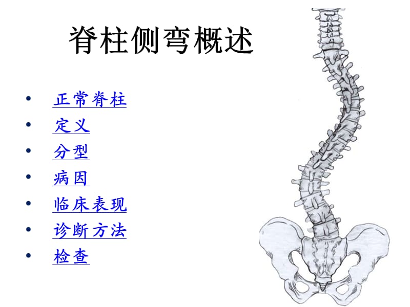 《脊柱側(cè)彎概述》ppt課件_第1頁