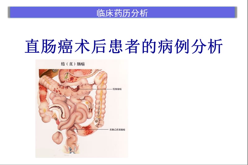 《直肠腺癌》ppt课件_第1页