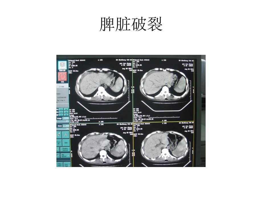 肝臟病例圖片PPT課件_第1頁